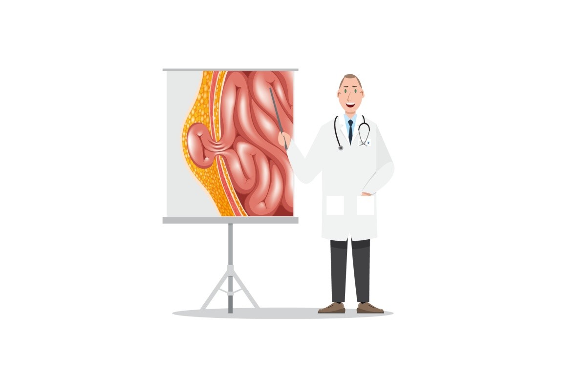 Why Do People Get Hernias? What Is Herniosis?
